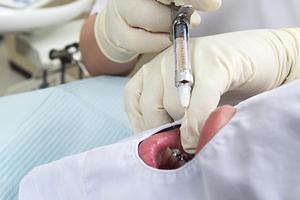 しっかり噛めることの意外なメリット