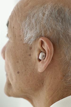 インプラントが初めてでも不安がない歯科